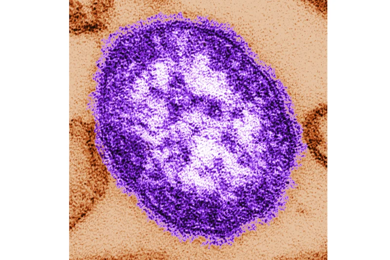 Pennsylvania says an unvaccinated woman has died from measles-related complications
